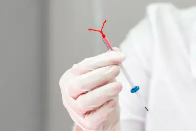 Doctors urged to treat pain for IUD insertion and other procedures