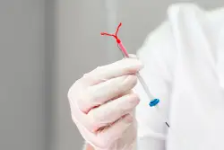 Doctors urged to treat pain for IUD insertion and other procedures